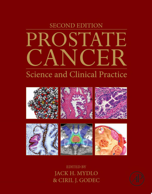 Prostate Cancer: Science and Clinical Practice, 2nd Edition
