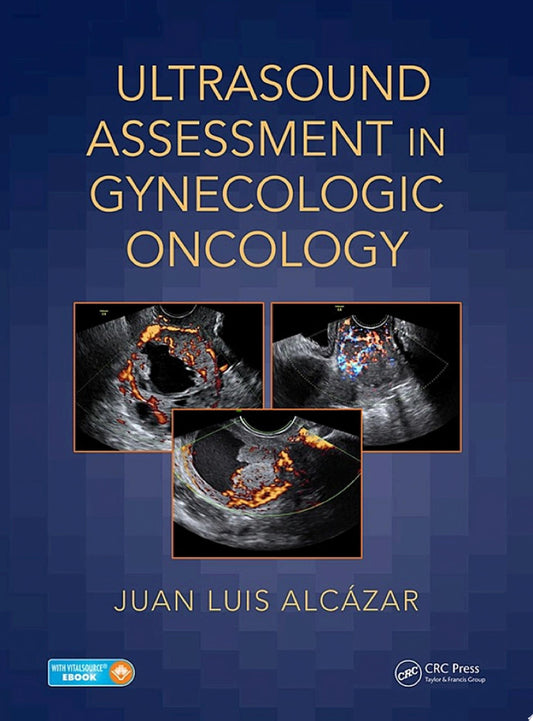 Ultrasound Assessment in Gynecologic Oncology