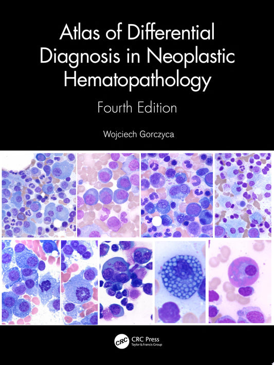 Atlas of Differential Diagnosis in Neoplastic Hematopathology, Third Edition