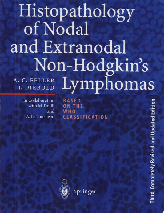 Extranodal Lymphomas