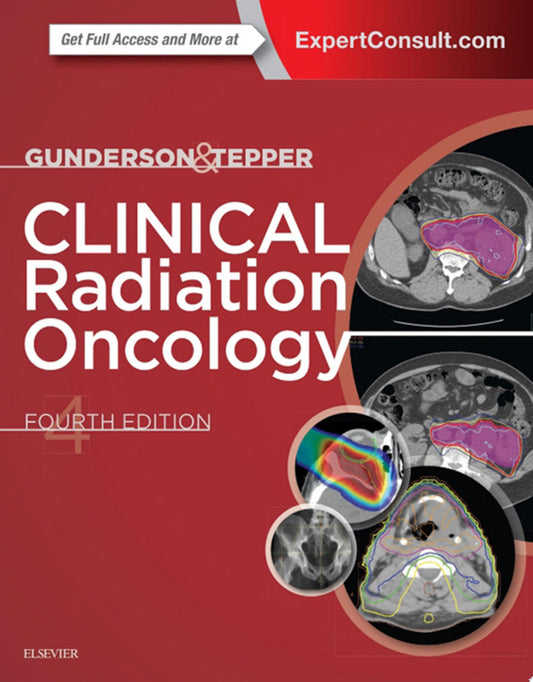 Intraoperative Radiotherapy for Breast Cancer , 2nd Edition