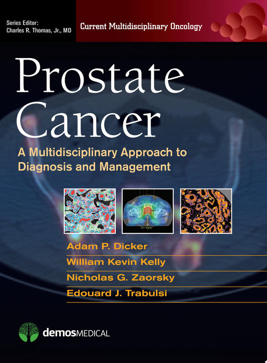 Prostate Cancer: A Multidisciplinary Approach to Diagnosis and Management