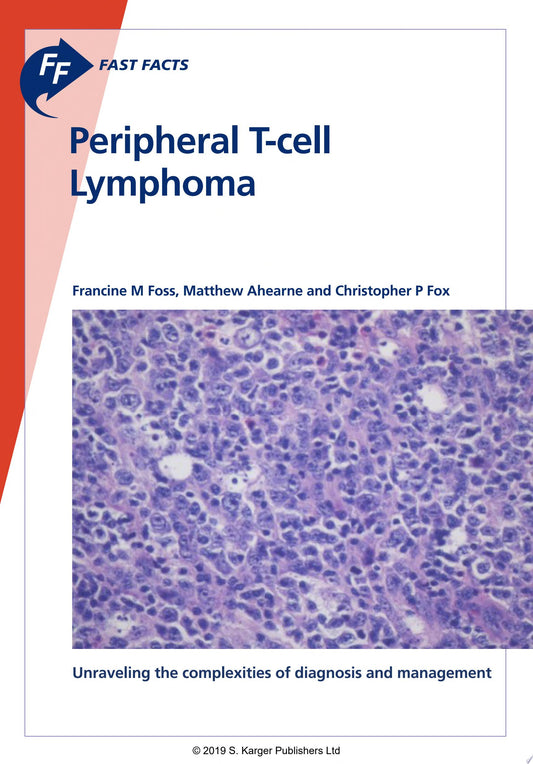 Fast Facts: Peripheral T-cell Lymphoma: Unraveling the complexities of diagnosis and management